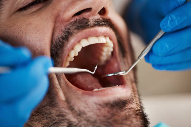 Best Emergency Dental Services for Seniors in Panhandle, TX